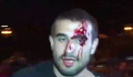 Полицейские жестко разгоняют митинг в Ереване, десятки пострадавших