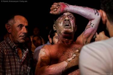 Совершивший в Ереване попытку самосожжения мужчина находится в крайне тяжелом состоянии