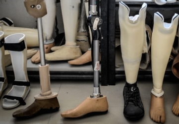 Качественные протезы – не роскошь, а необходимость