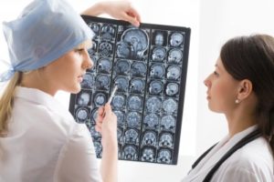 Ученые: Эпилепсию помогут вылечить новые технологии