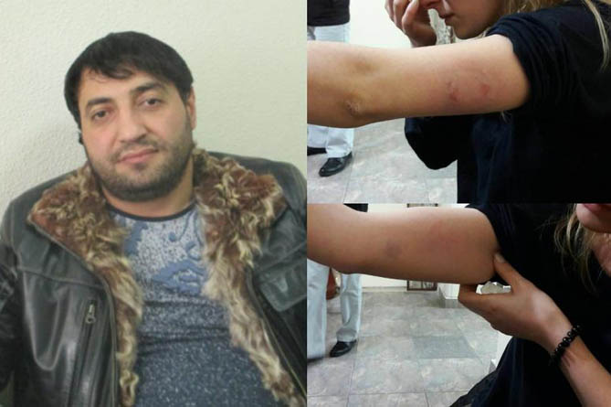 Прокуратура возбудила дело по нашумевшему инциденту с избиением женщины в центре Еревана