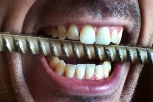 Ученые: Зубы человека влияют на его сексуальное развитие