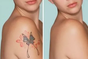 4 особенности татуировок на шрамах и рубцах, по мнению профессионалов tattookiev.org