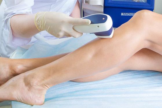 Лазерная эпиляция — как проводится