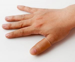 Из чего изготавливаются протезы  пальцев