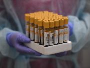 Академик поделился интересной находкой в иммунитете переболевших COVID-19