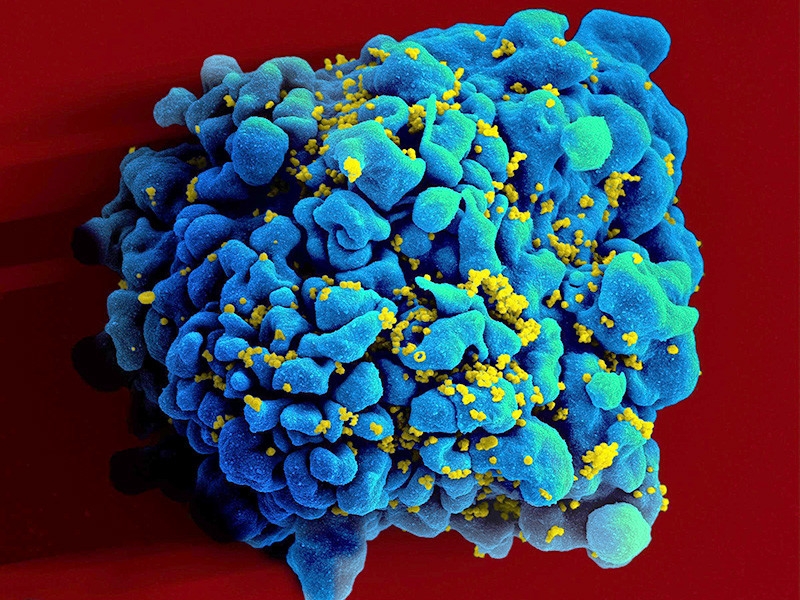 Учены нашли нулевого пациента с ВИЧ спустя 100 лет после первого заражения, произошедшего во время охоты на обезьян
