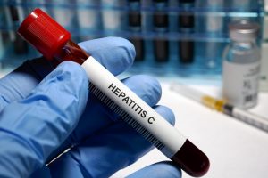 Методы диагностики и лечения Гепатита С
