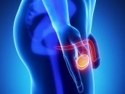 Гидроцеле: причины, симптомы, лечение