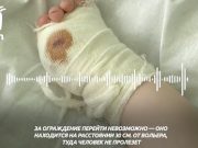 Мать ребенка с откушенным тигром пальцем раскрыла подробности произошедшего