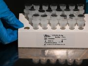 Мошенники начали обманывать россиян с бесплатными ПЦР-тестами