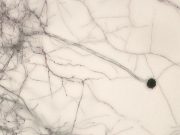 Оценена опасность поражающей зрение после COVID-19 «черной плесени» для России