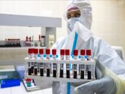 Центр Гамалеи выделил образец «омикрона» от заболевших россиян