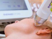 Что такое игольчатый RF лифтинг: показания к проведению процедуры и эффективности