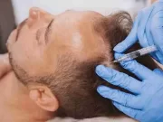 Эффективные методы лечения алопеции: советы и рекомендации