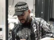 Киркоров удивил поклонников, показав руку после травмы