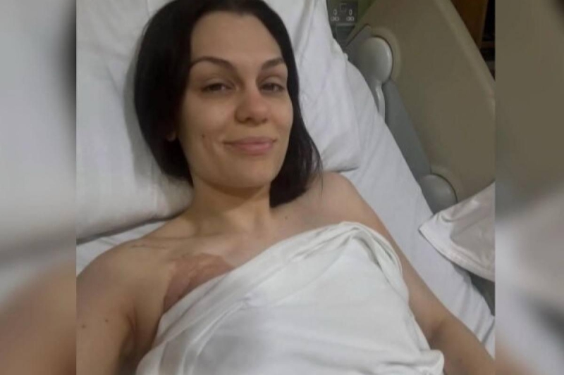 «Грустно не попрощаться»: певица Джесси Джей откровенно рассказала о мастэктомии и борьбе с раком