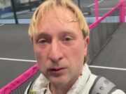 Фигурист Евгений Плющенко показал результат пластической операциишоу