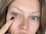 Рита Дакота показала результат повторной блефаропластики