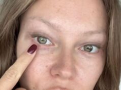 Рита Дакота показала результат повторной блефаропластики